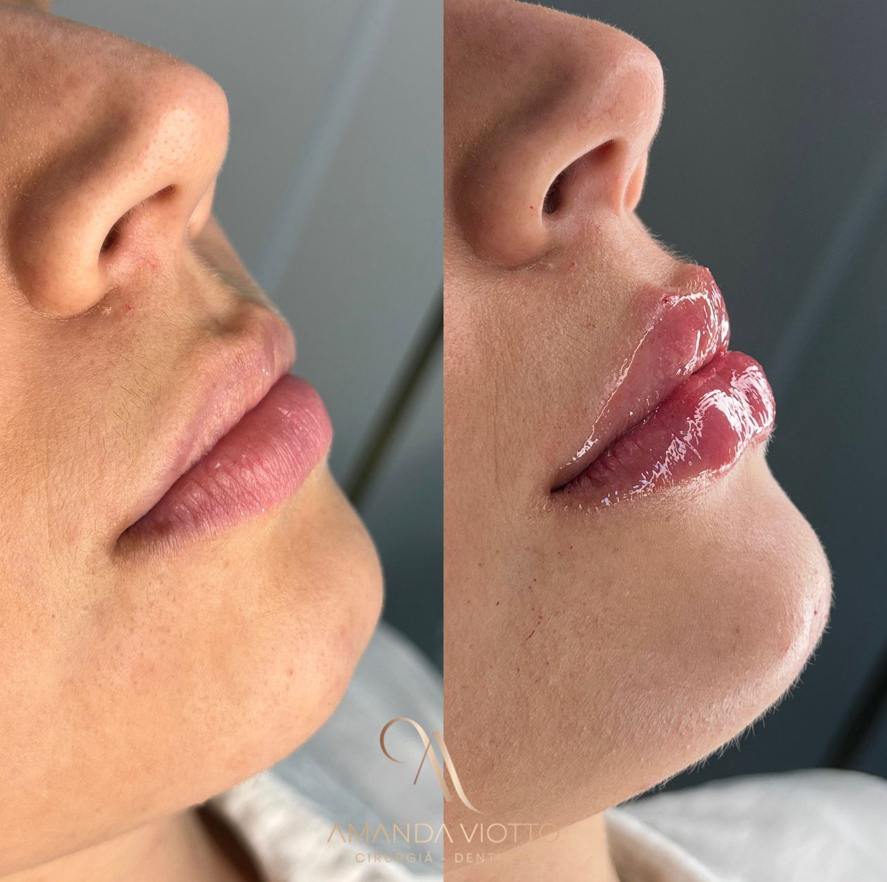 Resultado antes e depois 3